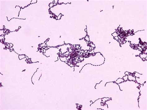 Streptococcus Pyogenes Shape