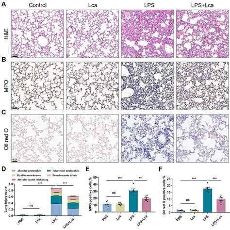 SciELO Brasil L Carnitine Reduces Acute Lung Injury Via Mitochondria