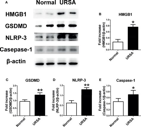 Frontiers Inhibition Of Hmgb1 Ameliorates The Maternal Fetal