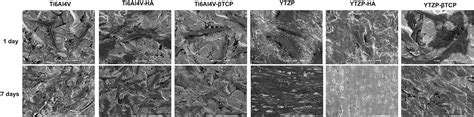 Scielo Brasil Gingival Fibroblasts Behavior On Bioactive Zirconia