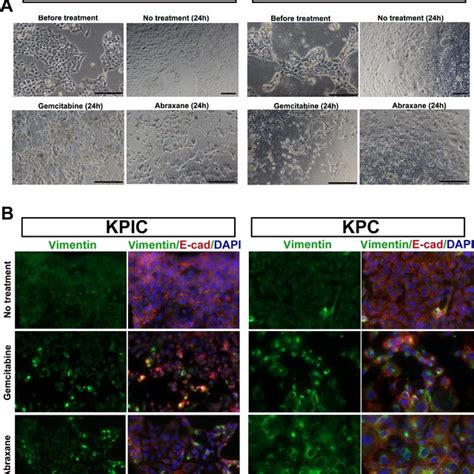 Kpic Cells Are Tumorigenic In Immunocompetent Mouse A The Gross