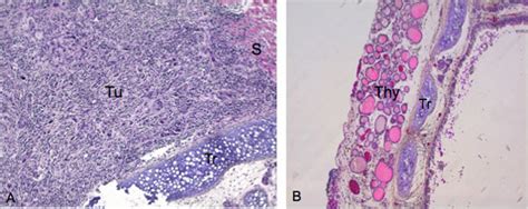 Histological Examination Of Tumor Growth And Invasion After Successful