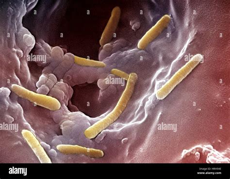 Pseudomonas infection hi-res stock photography and images - Alamy