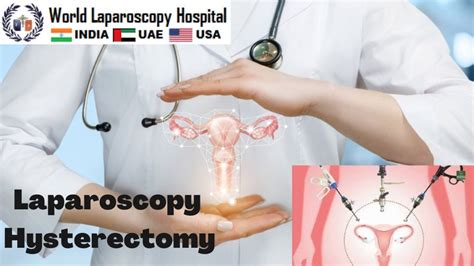 Laparoscopic Hysterectomy Steps