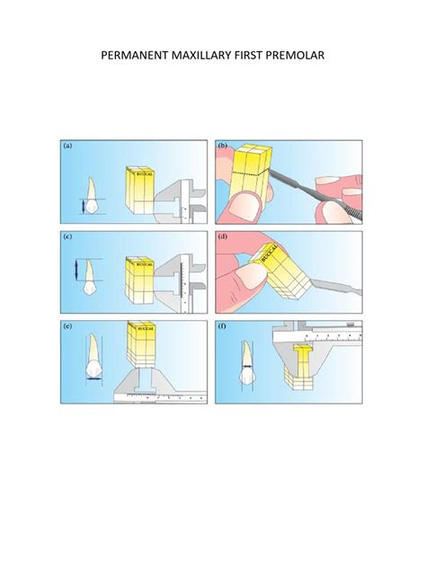 carving  permanent maxillary  premolar