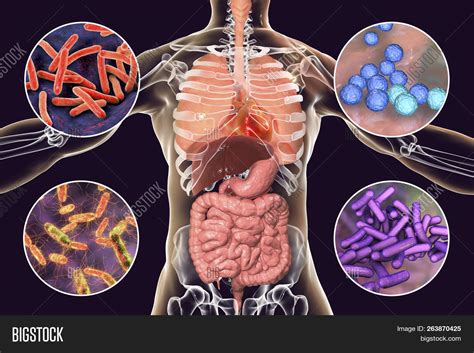 Human Pathogenic Image & Photo (Free Trial) | Bigstock