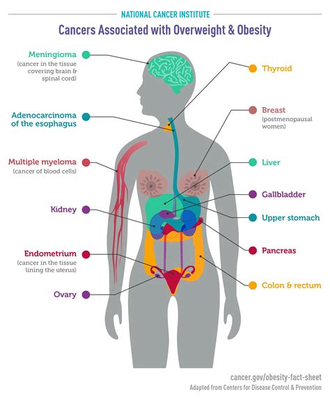 Nci Infographic Of Cancers Associated With Overweight And Obesity With