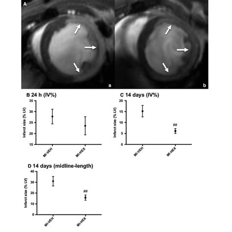 Infarct Size Measured By CMRI A Representative LGE Images Acquired