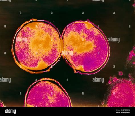 False Colour Transmission Electron Micrograph Tem Of The Gram