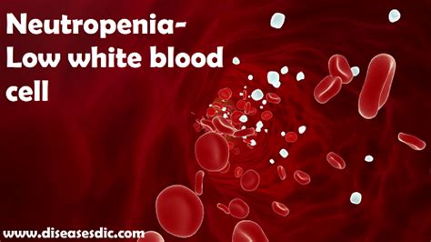 Neutropenia- Causes, Symptoms, Treatment and Prevention