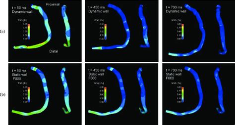 Instantaneous Wall Shear Stress Wss Contours On The Luminal Surface