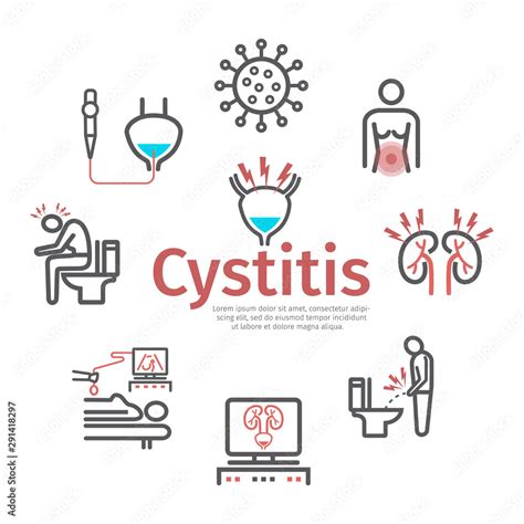 Cystitis banner. Symptoms, Treatment. Vector signs for web graphics. Stock Vector | Adobe Stock