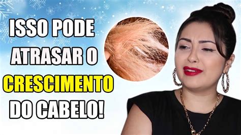 Como Cuidar Do Cabelo No Inverno Dicas Evitar Queda Ressecamento