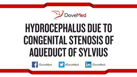 Hydrocephalus Due To Congenital Stenosis Of Aqueduct Of Sylvius Dovemed