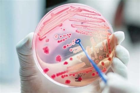 Bacterias multirresistentes marcan lucha farmacológica