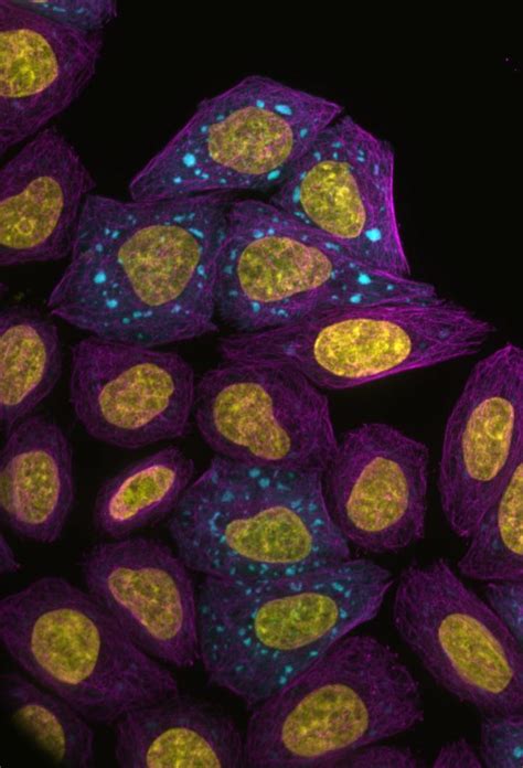 Fluorescence Microscopy Image IMAGE EurekAlert Science News Releases