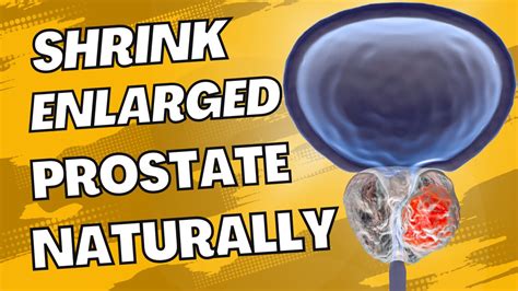 Shrink Enlarged Prostate With Natural Remedies