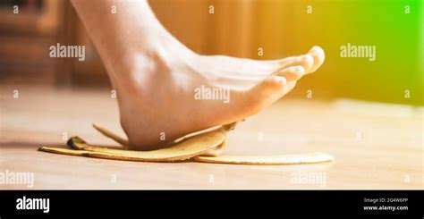 Leg Slip On Banana Peel And Have An Accident Stock Photo Alamy