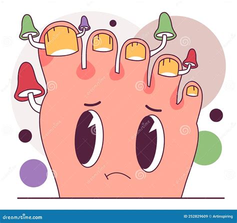 Onychomycosis. Nail Disease, Nail and Feet Fungal Infection Stock