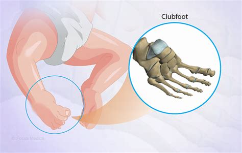 Health Condition Symptoms Causes Treatment And More