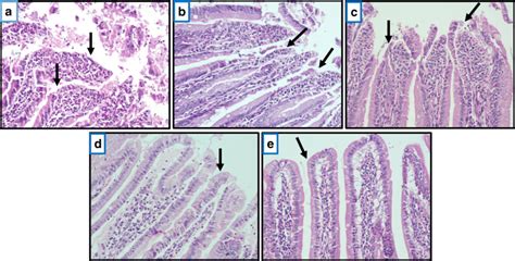 Representative Histological Sections Of Duodenal Mucosa Revealing The