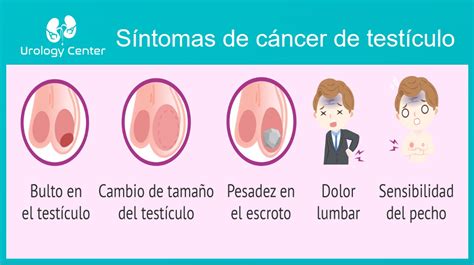 Qu Es El C Ncer De Test Culo Urology Center