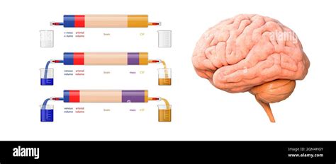 Brain Mass Arterial Volume Venous Volume Csf Cerebrospinal Fluid