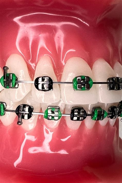 Green and Black Braces: 7 More Inspiring Green Braces Combinations in ...