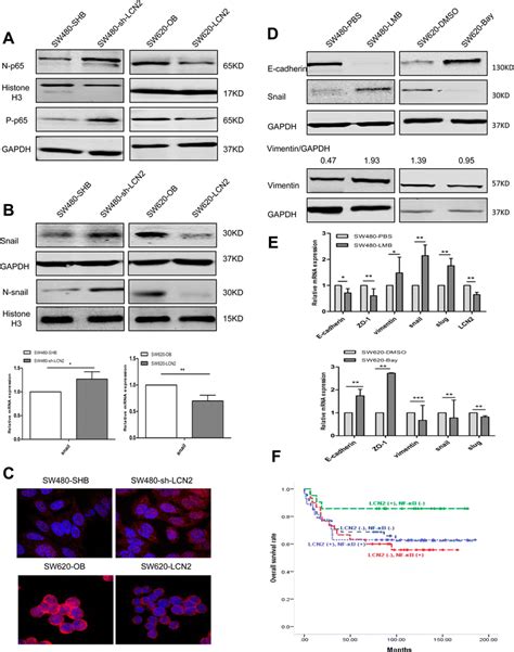 Lcn Suppresses The Nf B Snail Signaling Pathway And Attenuates Nf B