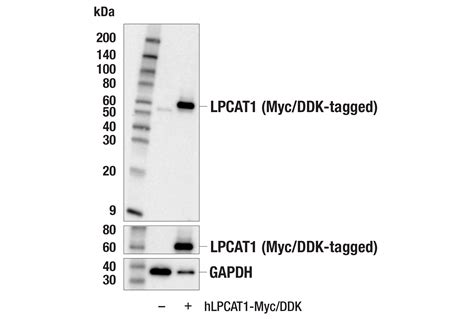 LPCAT1 E4V4B Rabbit MAb BSA And Azide Free Cell Signaling Technology