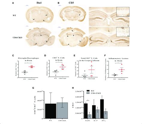 CD4 CKO Mice Have Significantly More Inflammatory Lesions CD3