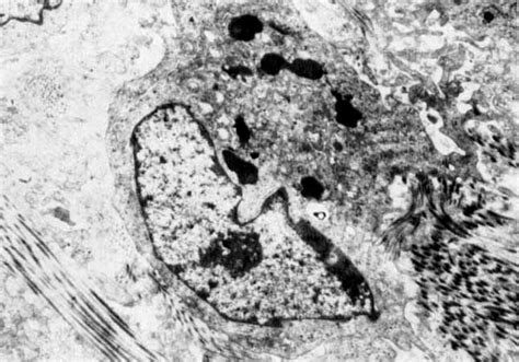 Low Power Electron Micrograph Of Cshh Proliferating Cells Have A