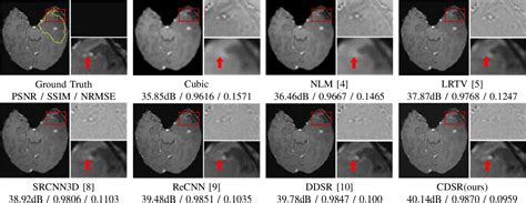 Figure From Brain Mri Super Resolution Reconstruction Using A Multi