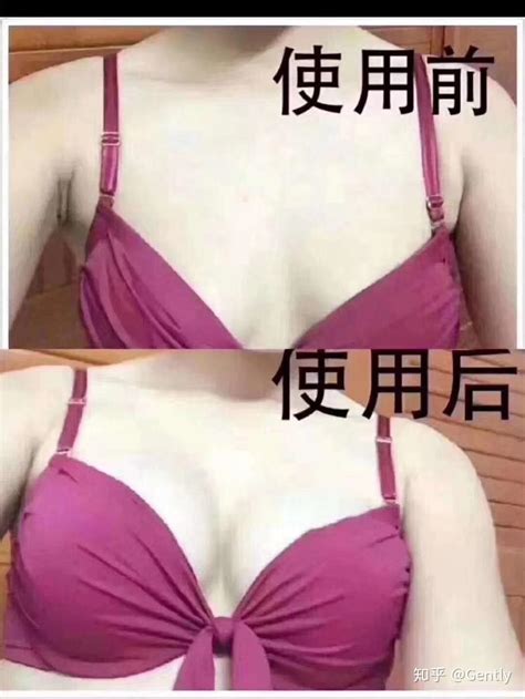 写一写自己的丰胸经历吧 知乎