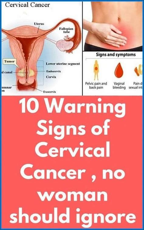 7 warning symptoms of cervical – Artofit