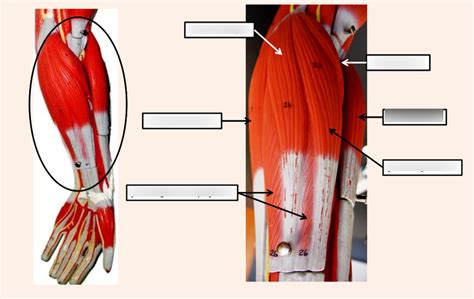 Anterior lower left arm Diagram | Quizlet