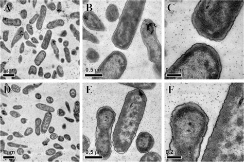 Pseudomonas Aeruginosa Cell Morphology