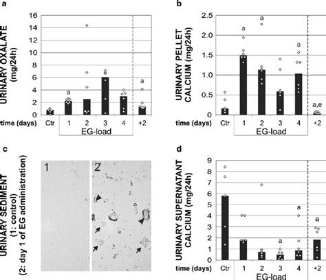 Urinary Biochemistry Showing Hyperoxaluria A An Increased Calcium