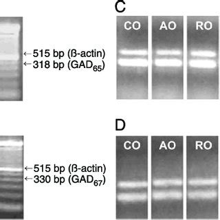 Ethidium Bromide Stained Agarose Gels Showing Rt Pcr Products Amplified