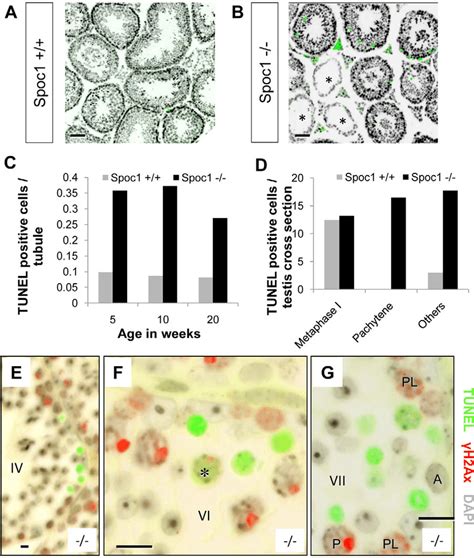 Increased Apoptosis In Spoc1 22 Testis Ab Apoptosis Tunel Green