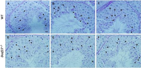 Periodic Acid Schiff Pas Staining Of Testes Sections From 8 Weeks Old