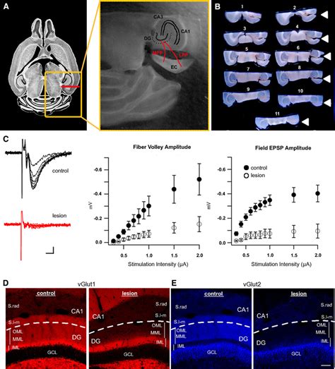 Complete Ablation Of Perforant Path Axons In The Adult Dentate Gyrus