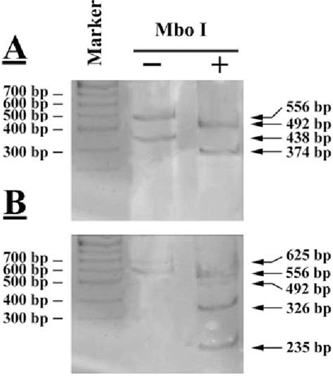 Figure From Evaluation Of Sensitivity And Specificity Of Urine