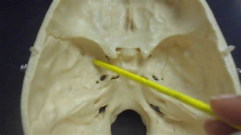 Sphenoid And Ethmoid Bones Youtube