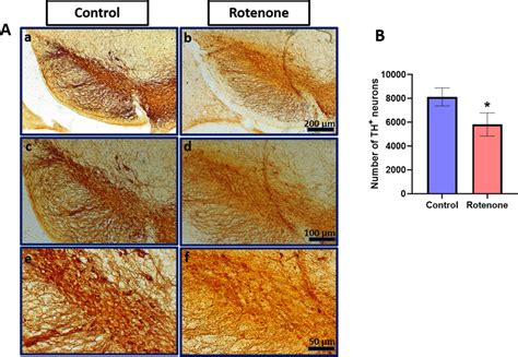 Effect Of Rotenone On Number Of DAergic Neurons In SN Of Mice After