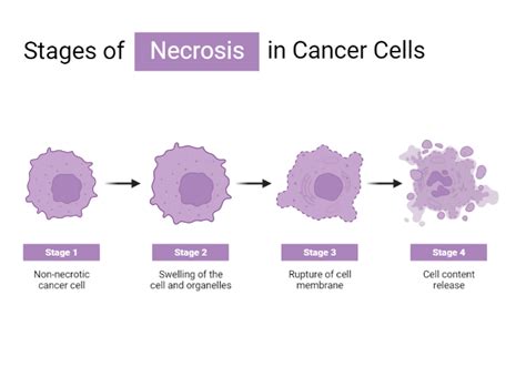 Stage Of Necrosis In Cancer Cells BioRender Science Templates