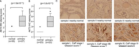 Protein Expression Of Akt3 In Normal Human Prostate Tissues Versus