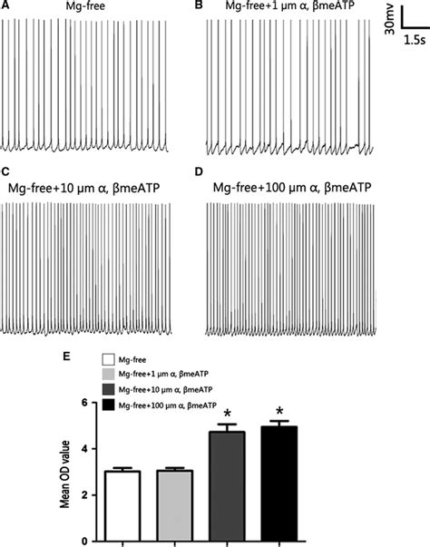 Whole cell recordings at different concentrations of α β meATP n 6