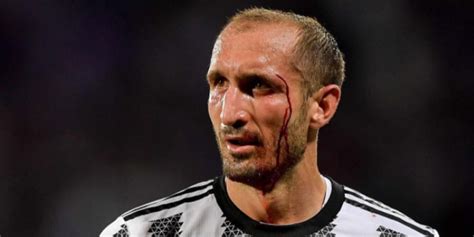 Juve Chiellini E Laddio Da Guerriero Fino Alla Fine