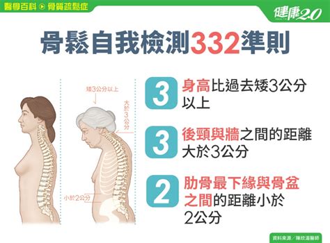 骨質疏鬆症／骨鬆會有什麼症狀？如何知道骨本夠不夠？「332」快速自我檢測熟齡隱形殺手骨折背部疼痛